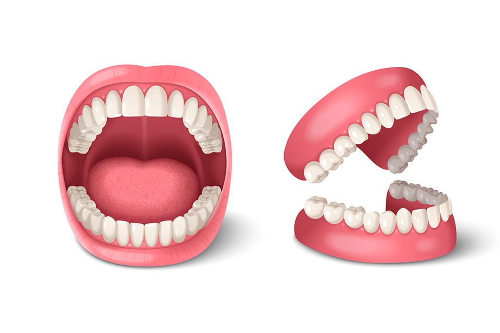 Dental Dentures