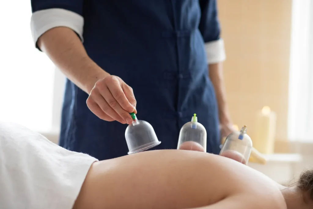 cupping therapy physioveda