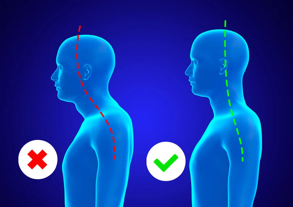 posture correction in dubai