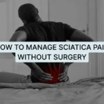 How to Manage Sciatica Pain Without Surgery