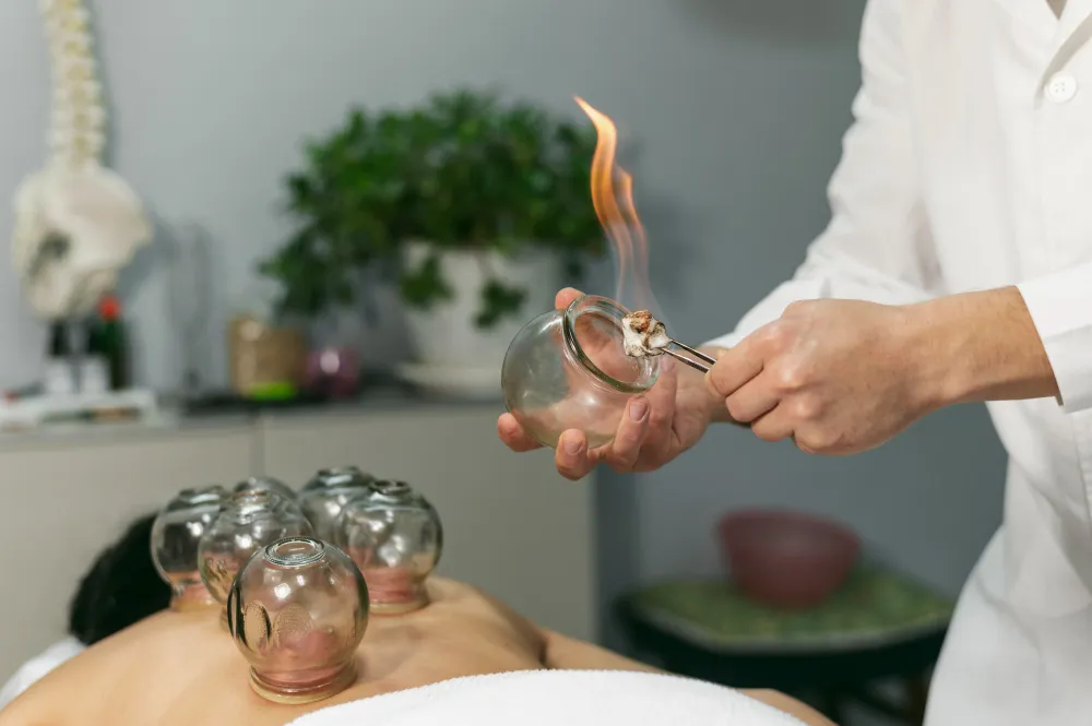 fire cupping
