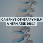 Can Physiotherapy Help a Herniated Disc