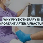 Why Physiotherapy Is Important After a Fracture